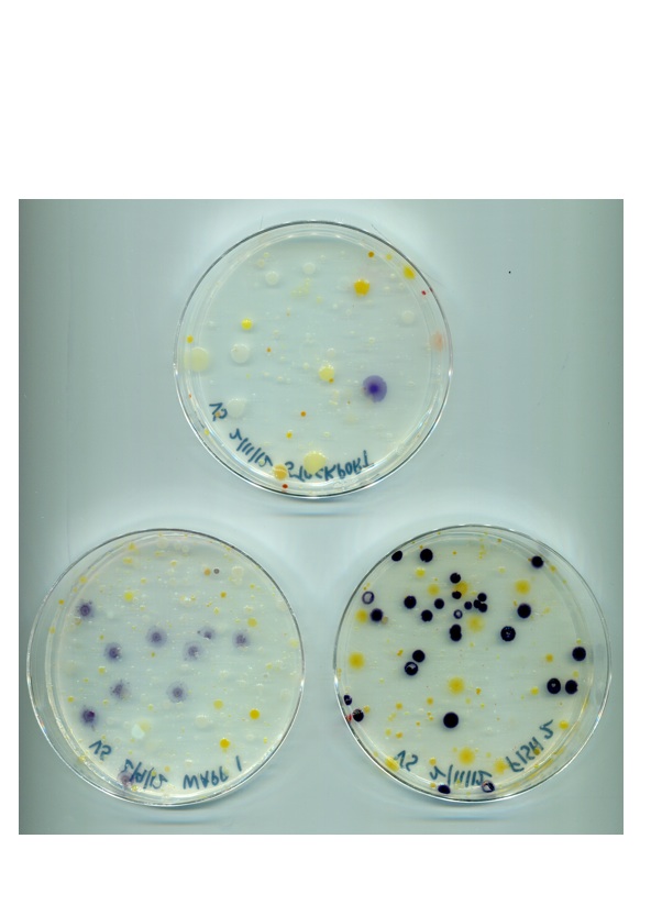 Hudson Valley Microbial Defenses: A Case for Violacein
