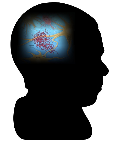 Molecular Mechanisms in Alzheimer's Disease
