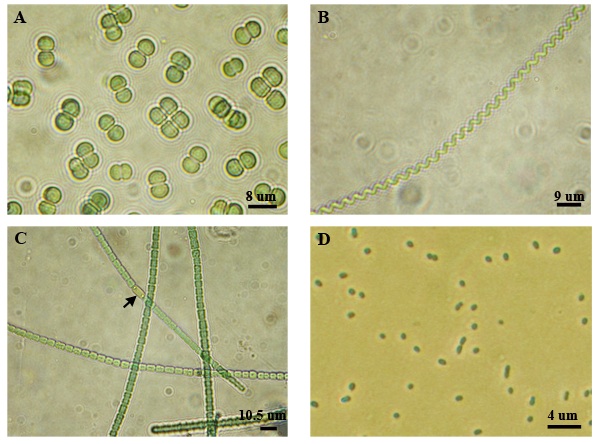 Cyanobacteria have evolved to thrive in a diverse range of habitats, including the oceans, and exhibit stunning morphological diversity. Although Prochlorococcus is the smallest, this marine cyanobacterium is a significant contributor to global photosynthesis. Clockwise from top:  Merismopedia, Spirulina, Prochlorococcus, Anabaena. (Adpated from Ting, 2014) 