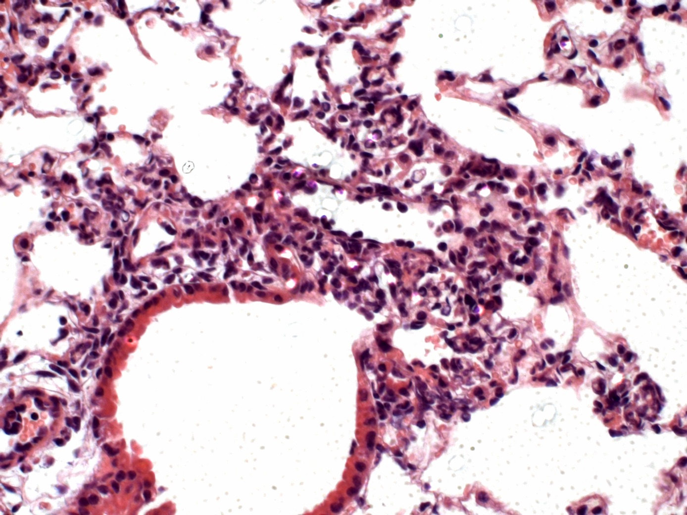 Macrophage-Colony Stimulating Factor Promotes the Survival of Mononuclear Phagocytes and Controls Secondary Liver Damage During Klebsiella Pneumonia