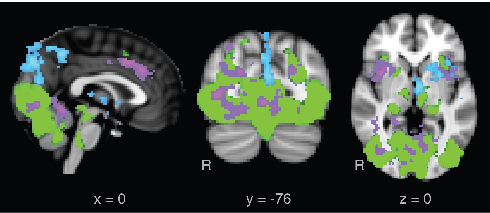 Stress and Memory:Effects on Multiple Memory Systems