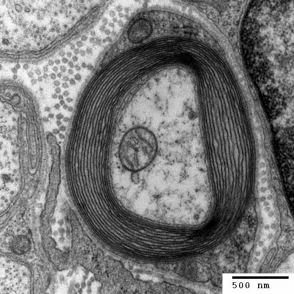 Image credit: Transmission electron micrograph of a cross-section of a myelinated axon, generated at the Electron Microscopy Facility at Trinity College, Hartford CT