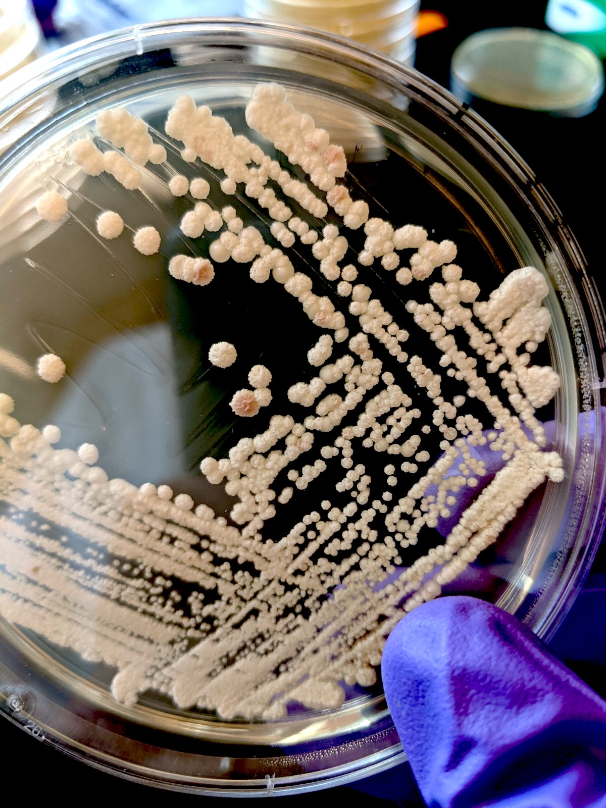 Probing the Eco-Evolutionary Dynamics&nbsp;of Microbial Systems