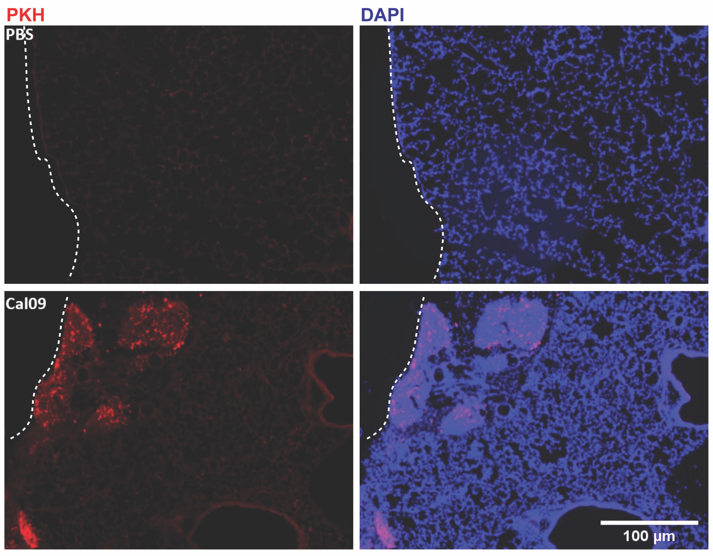 Serosal Macrophages as Drivers of Disease Recovery: A Case of the Flu